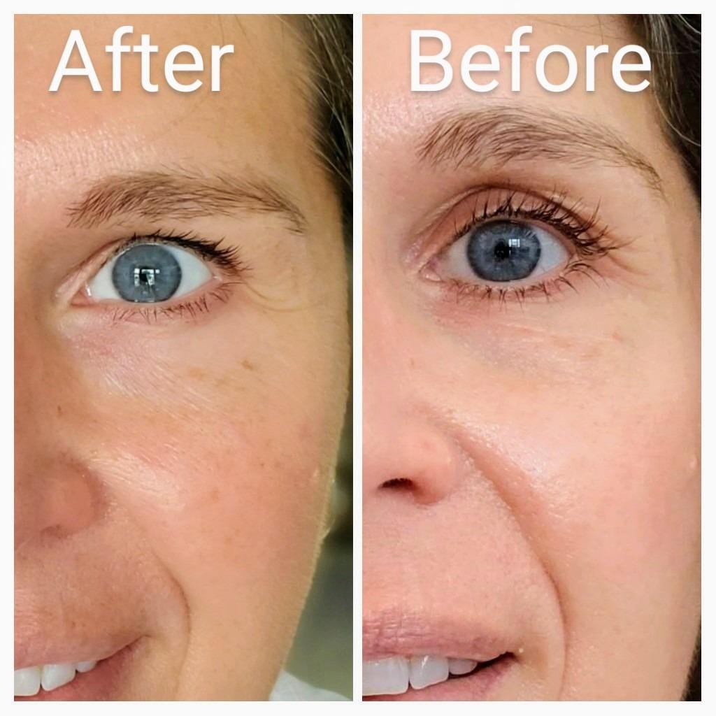 Top Anti-Aging Serums for Women Over 40 2025: Dermatologist-Approved Picks 3 Best anti-aging serums for women over 40 that reduce wrinkles and improve skin texture