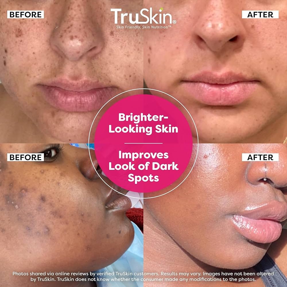 Top Anti-Aging Serums for Women Over 40 2025: Dermatologist-Approved Picks 16 8188TMoH5L. UF10001000 QL80