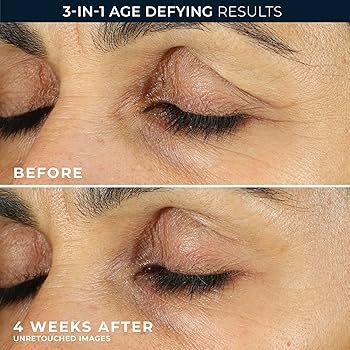 Best Eye Creams for Dark Circles Under $50 in 2025 | Top Picks for Bright Eyes 10 91QxTNqOLyL. UF350350 QL80 1