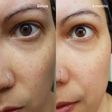 Top Anti-Aging Serums for Women Over 40 2025: Dermatologist-Approved Picks 12 images