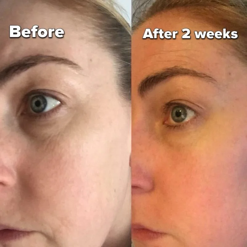 Best Eye Creams for Dark Circles Under $50 in 2025 | Top Picks for Bright Eyes 6 Best eye creams for dark circles under $50 in 2025