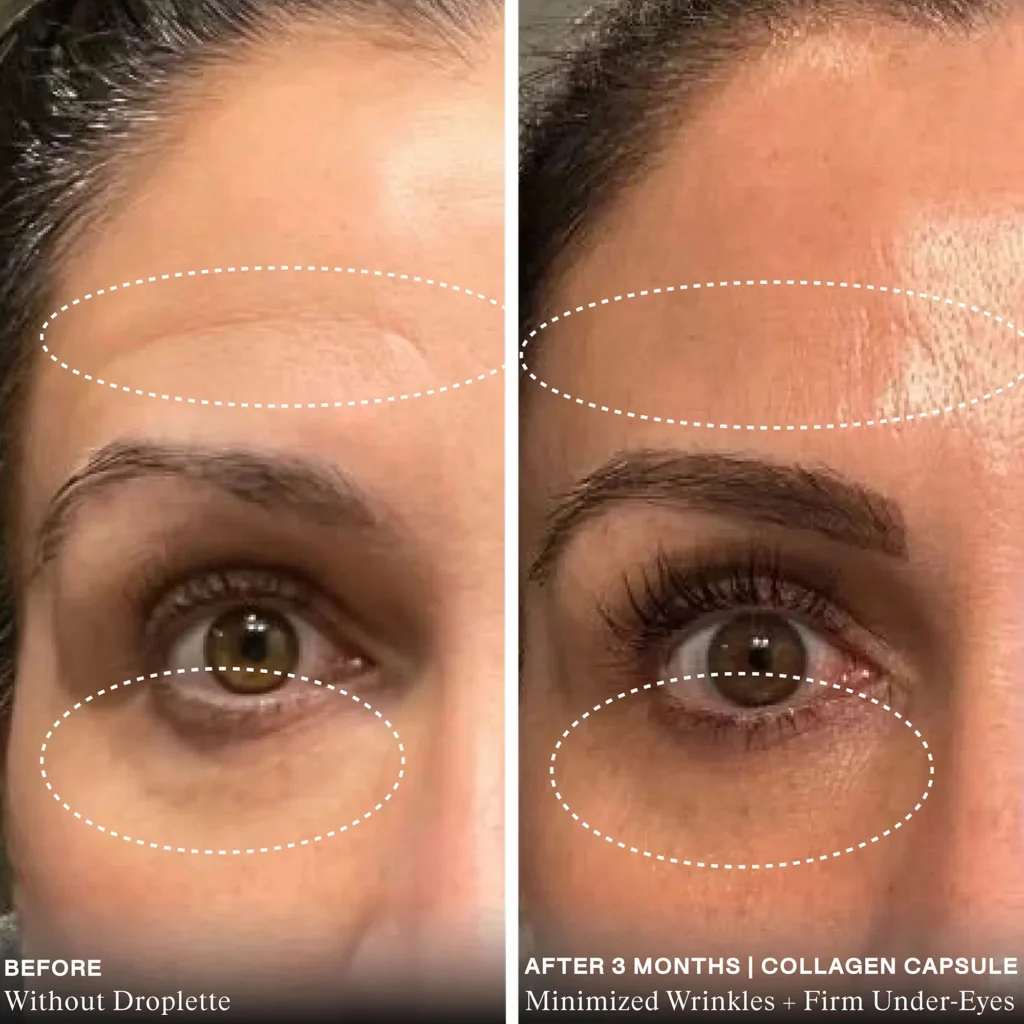 Best Anti-Aging Serums for Wrinkles and Fine Lines in 2025 | Top Dermatologist-Recommended Picks 9 Collagen BA