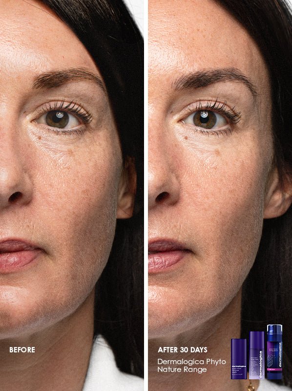 Best Anti-Aging Serums for Wrinkles and Fine Lines in 2025 | Top Dermatologist-Recommended Picks 13 FullFace BeforeAfter Alicia 1