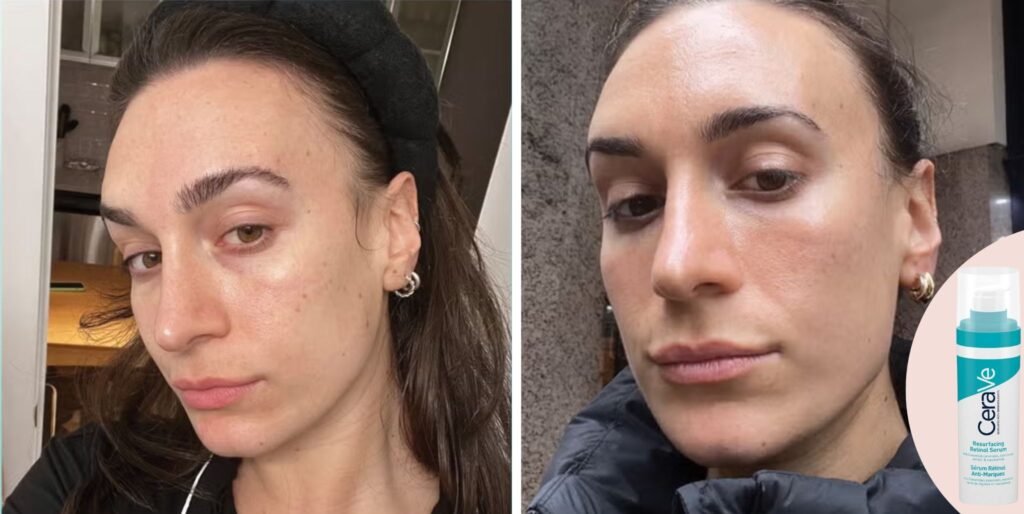 Best Anti-Aging Serums for Wrinkles and Fine Lines in 2025 | Top Dermatologist-Recommended Picks 11 cerave retinol serum review 68135960c523f