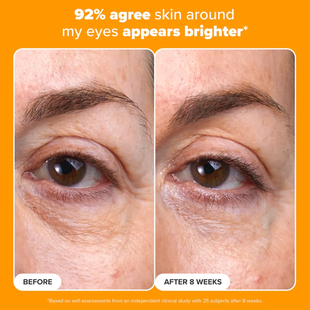 Best Anti-Aging Serums for Wrinkles and Fine Lines in 2025 | Top Dermatologist-Recommended Picks 5 best anti-aging serums for wrinkles and fine lines 2025